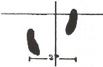 daruma-taiso